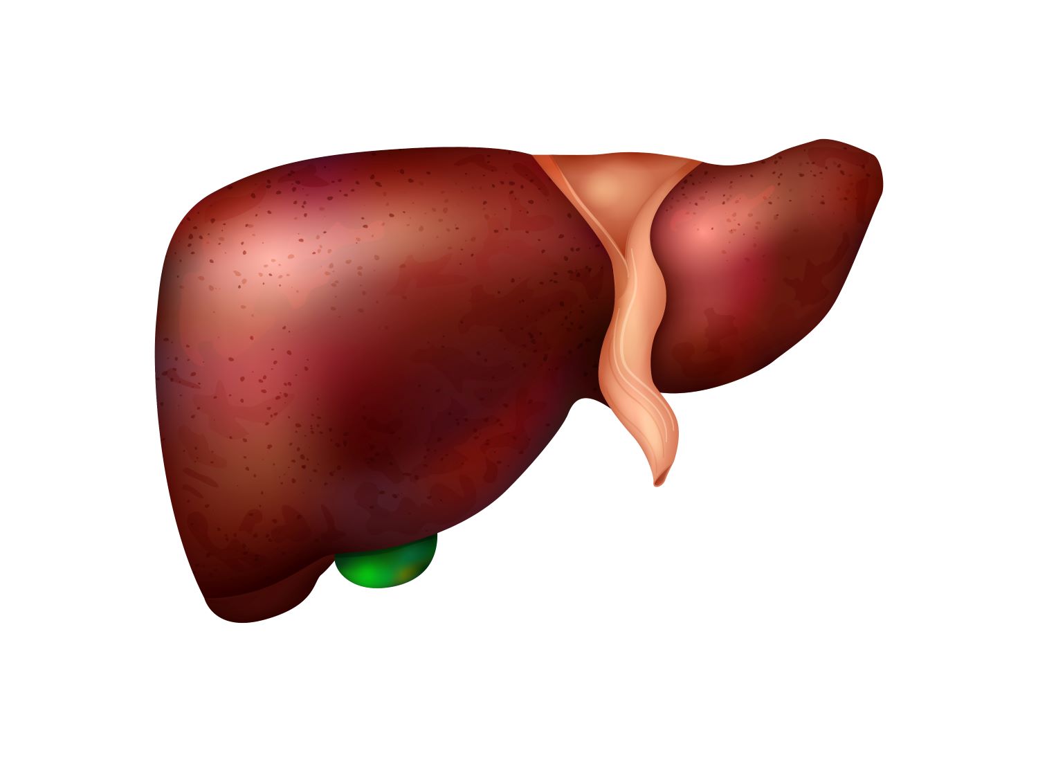 fígado com esteatose hepática